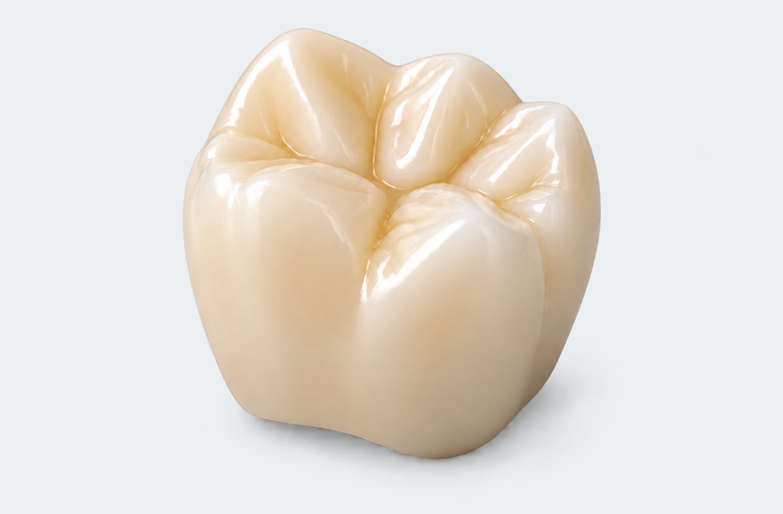 Full-Contour Zirconia Crown